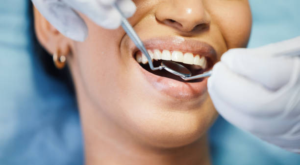 Best Emergency Dental Care for Broken or Chipped Teeth in Tusculum, TN