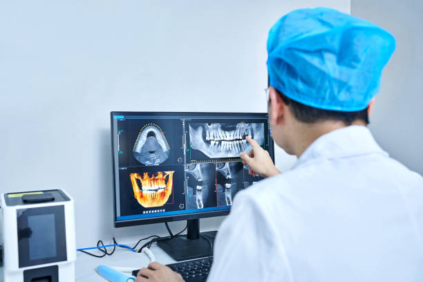Best Emergency Wisdom Teeth Removal in Tusculum, TN